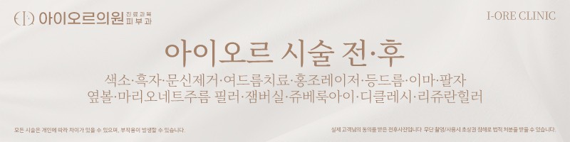아이오르 시술전후