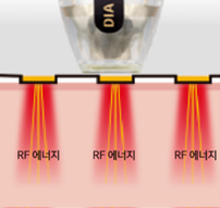 모노폴라 방식