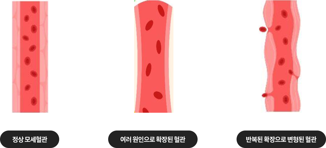 혈관 이미지